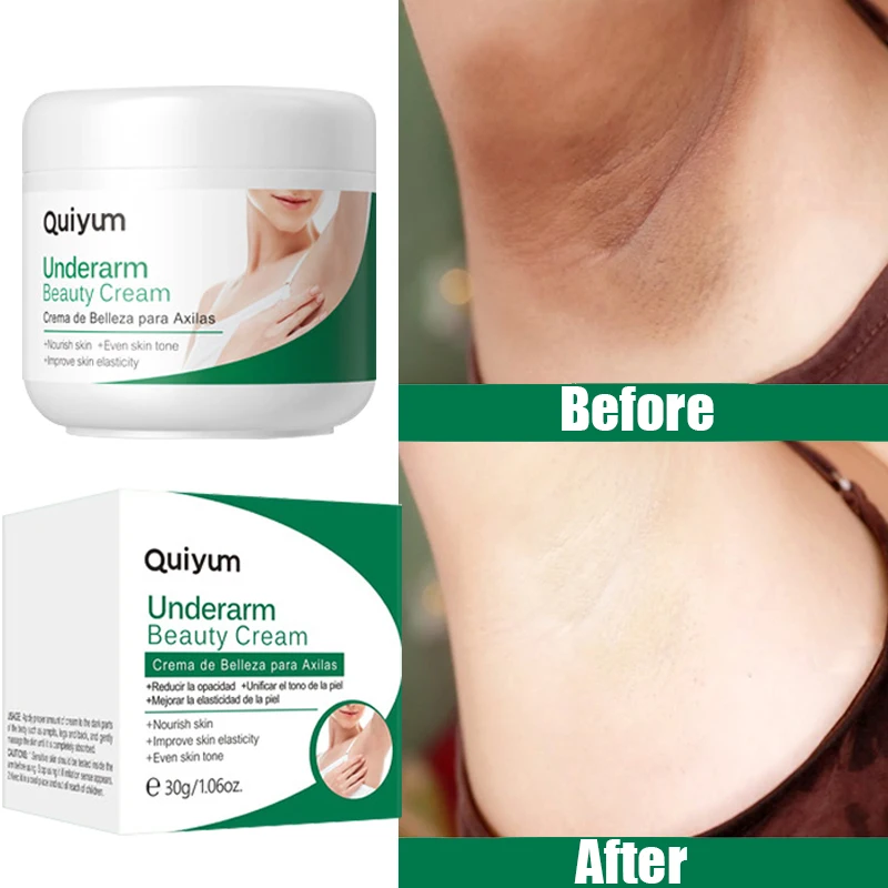 

Body Whitening Cream Underarm Elbow Legs Private Parts Bleaching Remove Melanin Pigmentation Deep Moisturizing Bright Skin Care