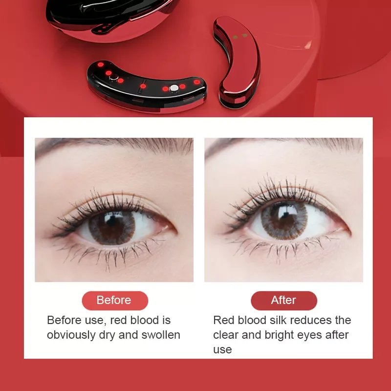 Антивозрастное устройство для 3d-вибрации глаз со светодиодной подсветкой