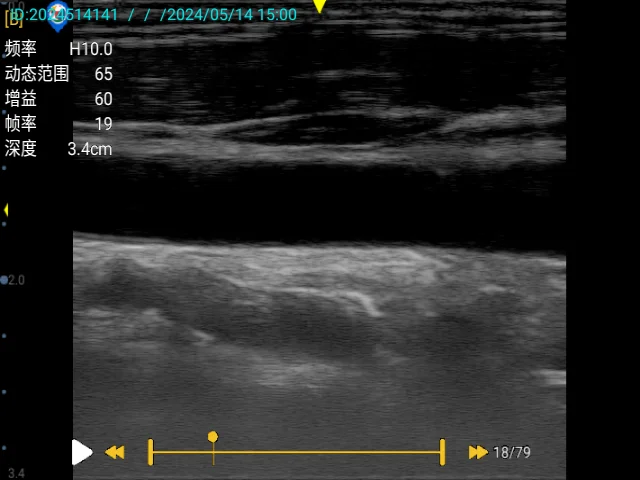 2024 новая модель BPU50B B/W 32-канальный ультразвук с PW хорошая цена портативный