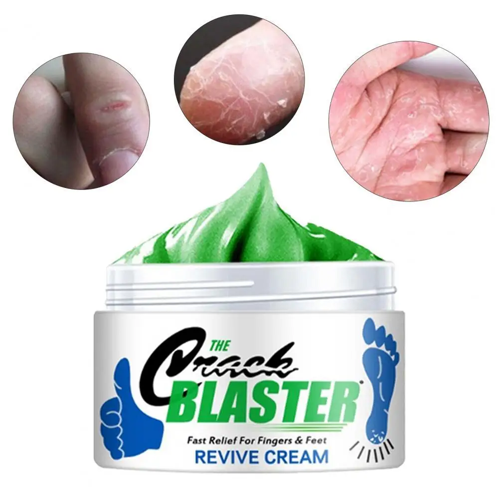 

Practical Cracked Feet Cream Skincare Callus Remover Deeply Moisturize Anti-allergy Exfoliates Dead Skin Feet Neck Cream
