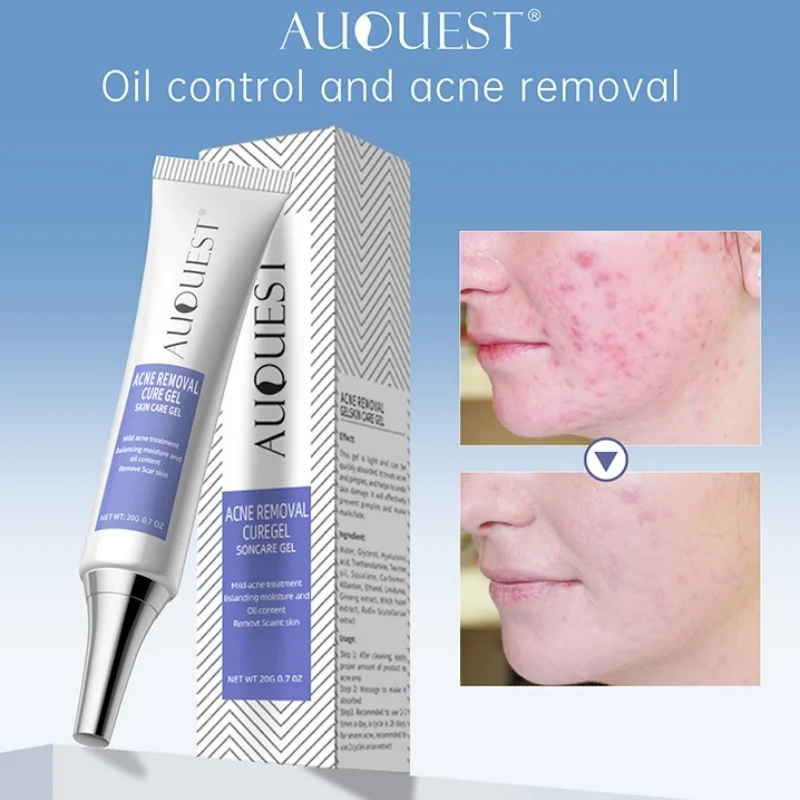 

AUQUEST Herbal Acne Removal Cream Pimple Treatment Shrink Pores Fade Dark Spot Mark Teens Oil Control Scar Gel Skin Care Product