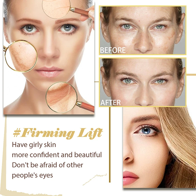 Рисунок 4 - Антиморщинистый крем