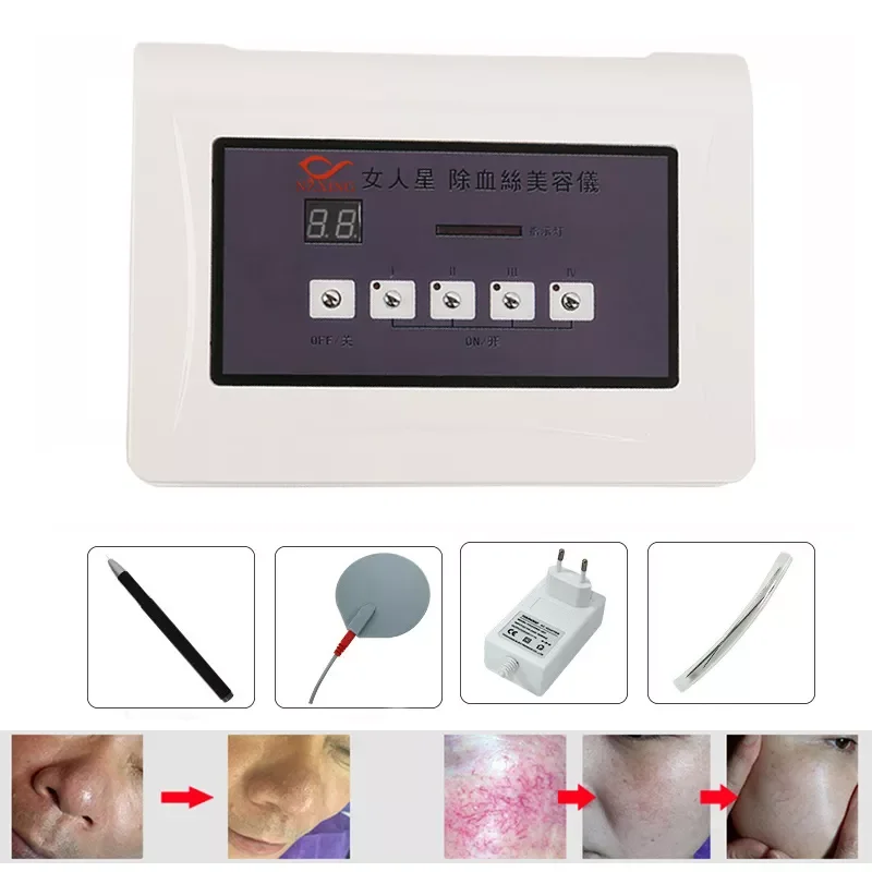 

NEW2023 High Frequency Spider Veins Removal Machine Spa Salon Blood Redness Vascular Remover Beauty Equipment