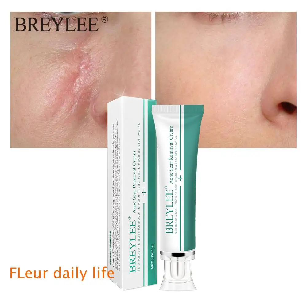 

5Pieces Breylee Removal Scar Cream Face Pimples Scar Stretch Marks Removal Acne Treatment Whitening Moisturizing Cream Skin Care