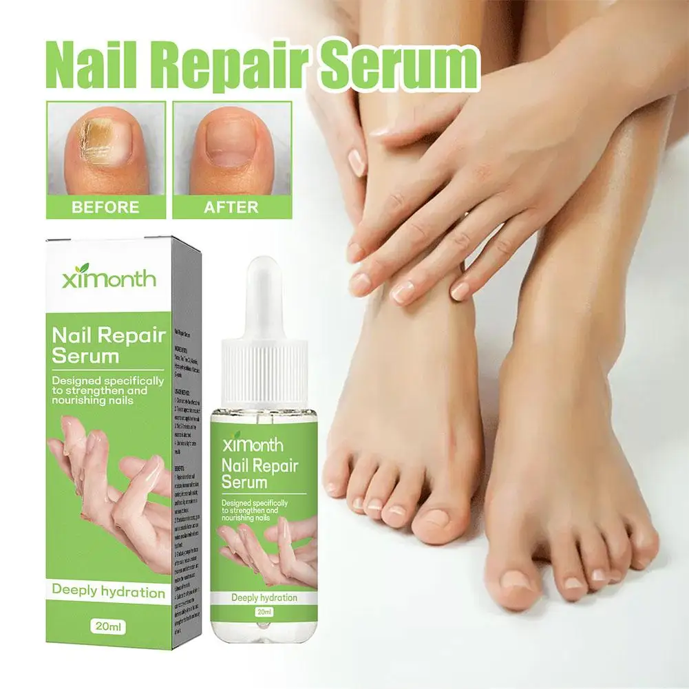 

20ml Nail Treatment Serum Foot Repair Essence Care Nails Cleaning Whitening Toe Gray Nail Beauty Health Removal Thickened P9O6