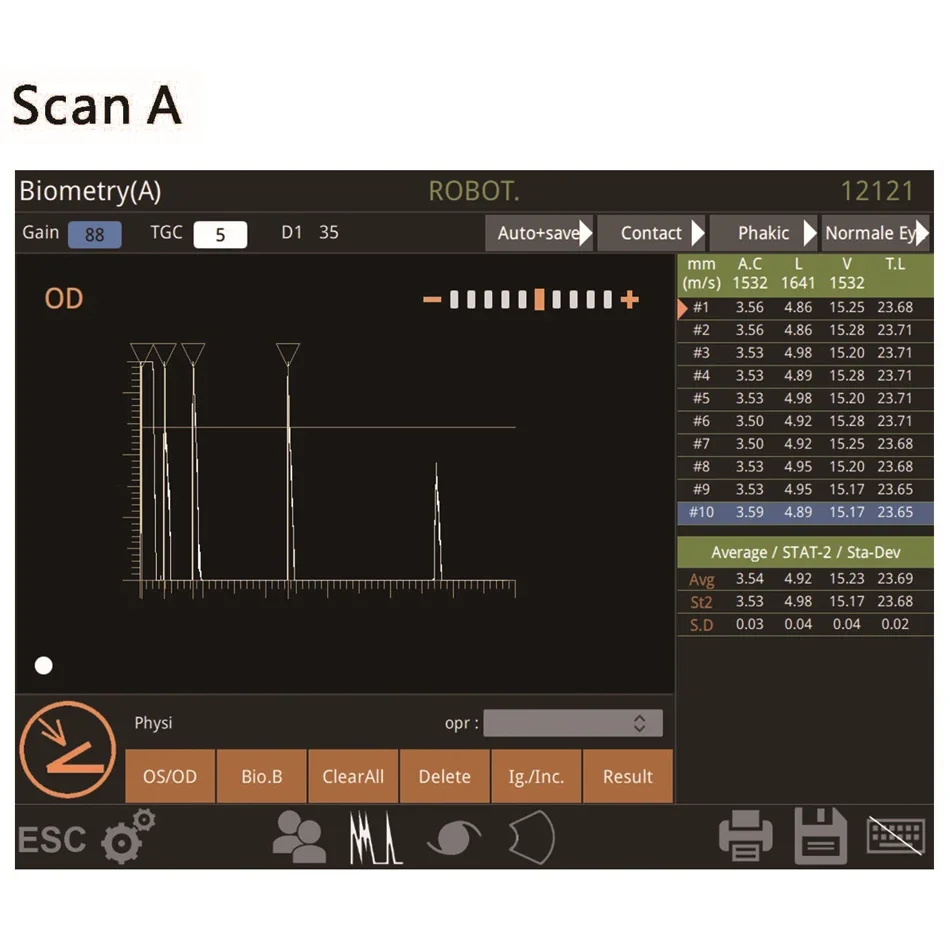 Офтальмологический сканер RetiWave-1000 Пахиметр Биометр Офтальмологическое