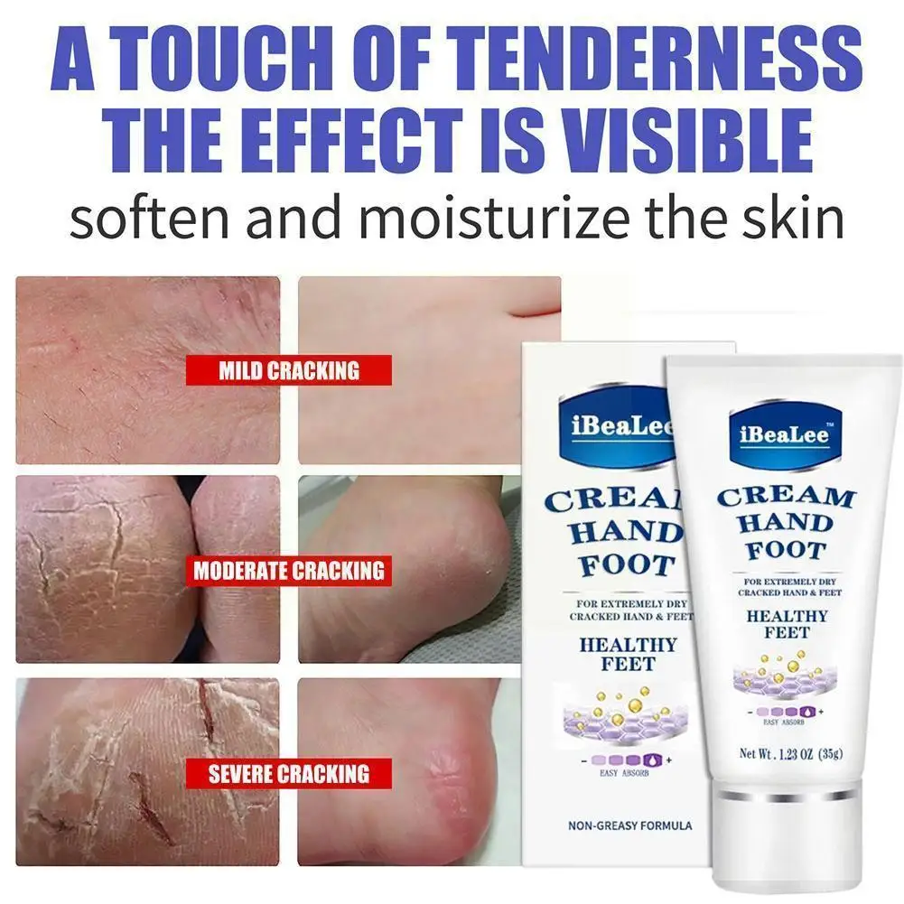 

Крем для удаления пятки и мозолей на ногах, 35 г