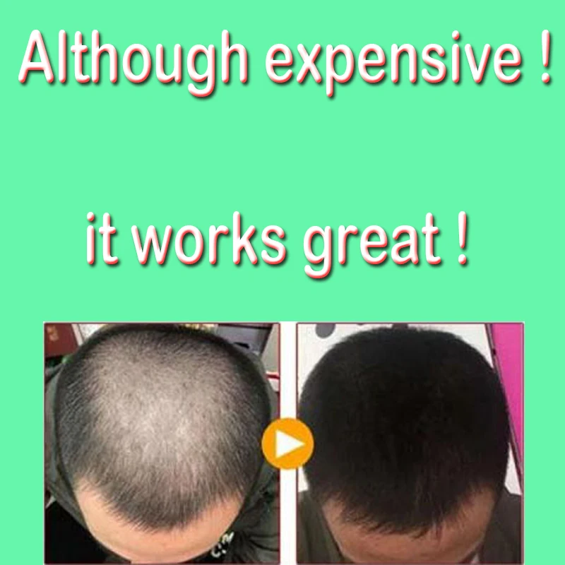 20ml Hair Care Hair Growth Essential Oils Essence Original 100% Hair Loss Liquid Health Care Beauty Dense Serum free shipping
