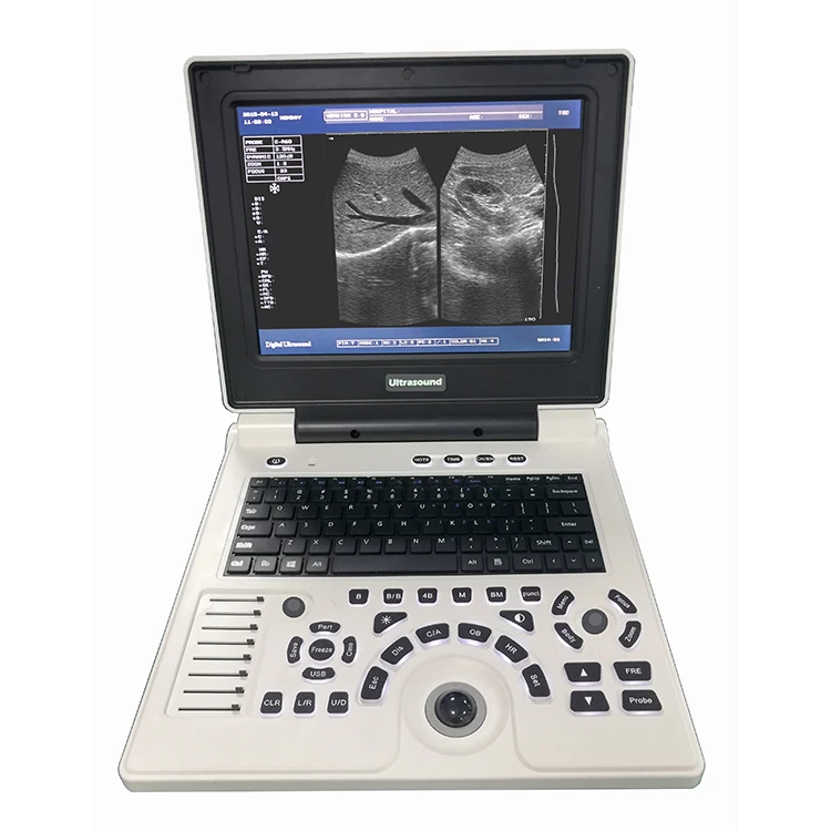 

XF30B Fetal Biometrics Phantom Mobile Scanner Therapy Ultrasound Equipment