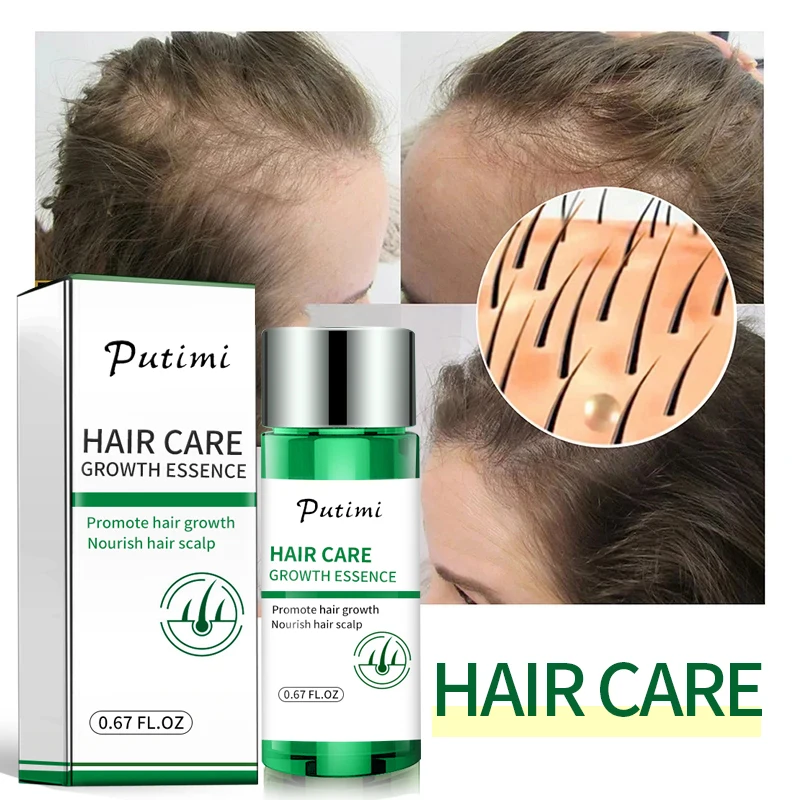 Эффективная Сыворотка для роста волос раньше эссенция предотвращает облысение