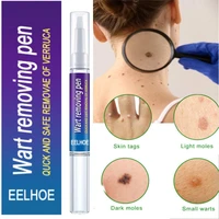 warts remover liquid pen antibacterial herbal extract ointment wart treatment cream skin tag remover corn plaster warts ointment