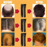 westmonth roller ball massage anti loss long hair liquid improves hair strength anti break hair dense hair long hair liquid
