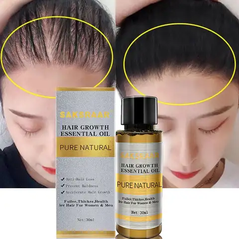 Hair care Essential oil for hair growth Essence Original genuine 100% liquid for hair loss Healthy media