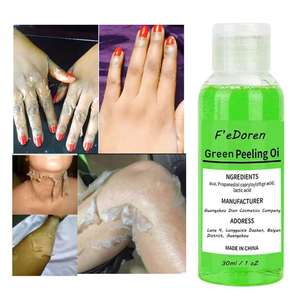 

30/50ML Yellow Peeling Oil Dark Spot Remover Skin Bleaching Brightening Oil Deep Peeling Exfoliating Serum For Face Body