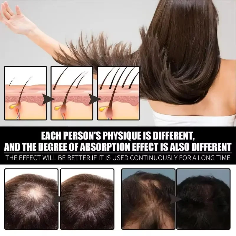 Сыворотка для роста волос 7 дней