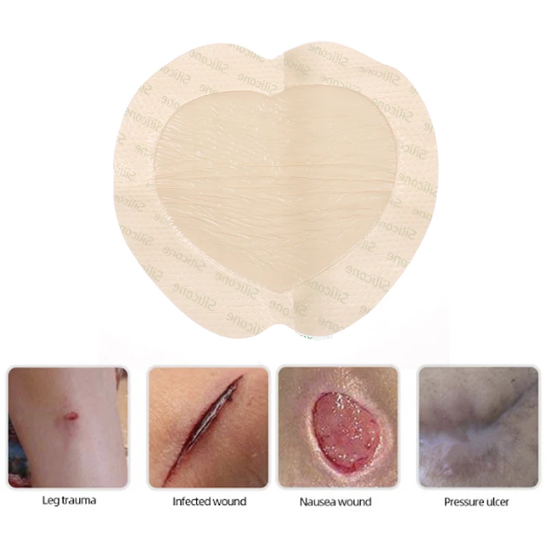 

Medical Soft Silicone Viscose Sterile Dressing Bedsore Patch Treat Decubituses/Pressure Ulcer Festering Wound Healing 18cm*18cm