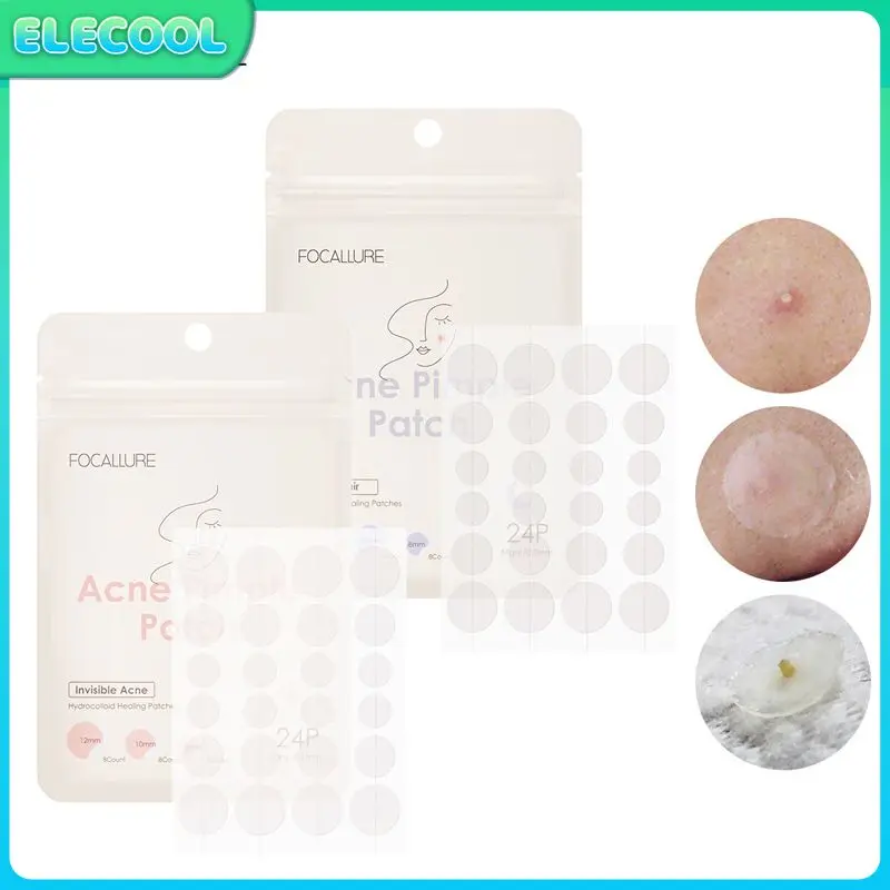 

Acne Pimple Patch Invisible Professional Healing Absorbing Spot Sticker Covering Skin Tag Remover Patch Hydrocolloid For Xiaomi