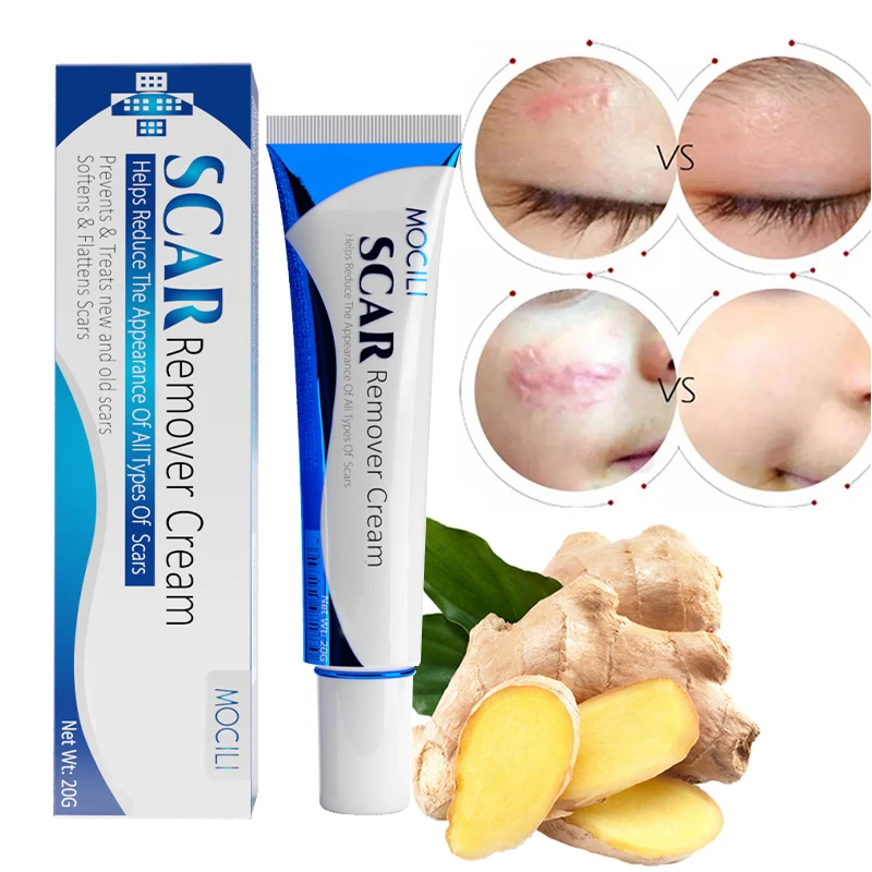 

Scar Removal Cream Ginger Root Oil Repair Burn Surgery Scar Treatment Acne Scar Stretch Marks Whitening Smooth Body Beauty Care