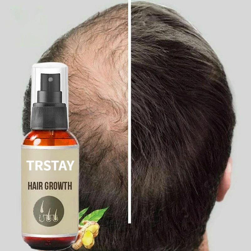 Extract Prevent Hair Loss Growing Hair For Men Professional Brazilian Keratin Spray Growth For Men