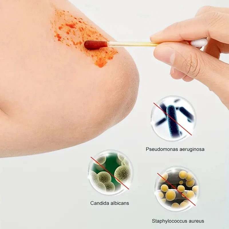 Одноразовые Тканые Ватные Тампоны С Йодным Стерилизованным Спиртовым