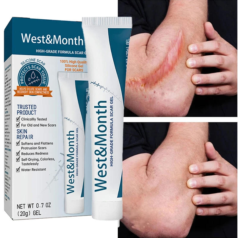 

Scar Removal Cream Gel Repaire Pock Mark Burn Surgical Scar Cesarean Fade Scar Stretch Mark Treatment Whitening Cream Skin Care