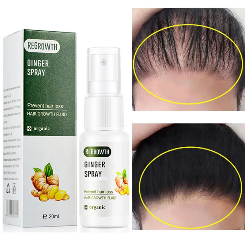 Fast ReGrow Ginger Hair Growth Spray Prevent Hair Loss Product Baldness Restore Scalp Treatment Germinal Hair Serum Men Women