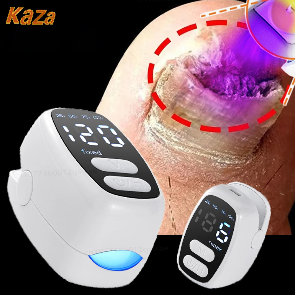 Грибковое средство для лечения Ногтей искусственное обесцвечивание ногтей