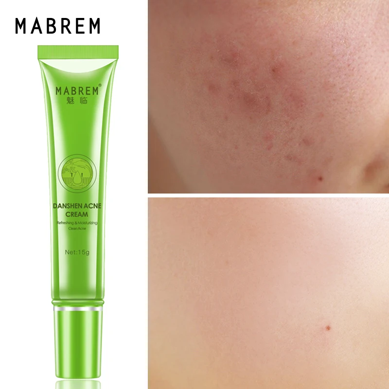 

Крем от акне MABREM, Осветляющий, восстанавливающий и увлажняющий крем для сужения пор