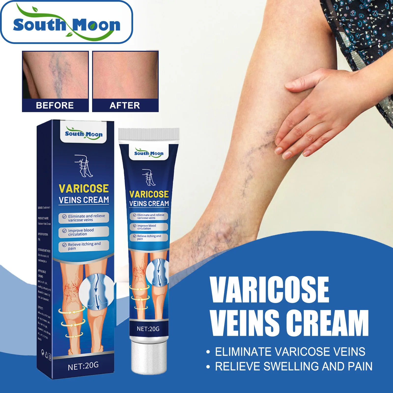 Varicose Vein Massage Varicose Vein Cream Relief of Bulging Legs Varicose Veins Earthworm Leg Repair