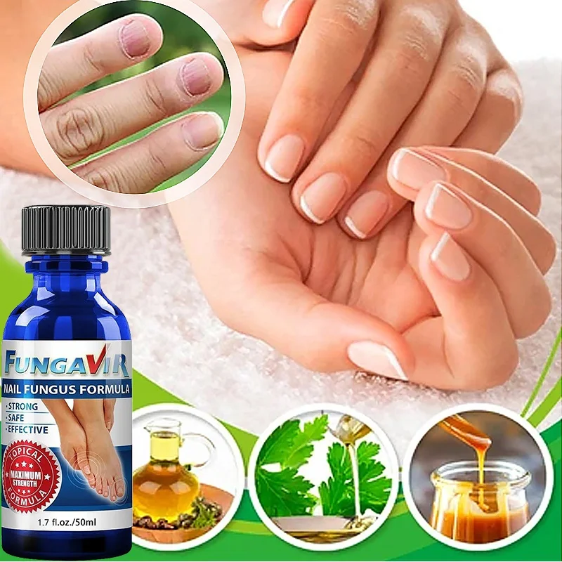 

2022 Best Nail Repair Stop Fungal Growth Effective Fingernail & Toenail Health Care Solution Fix & Renew Damaged Cracked & Dis