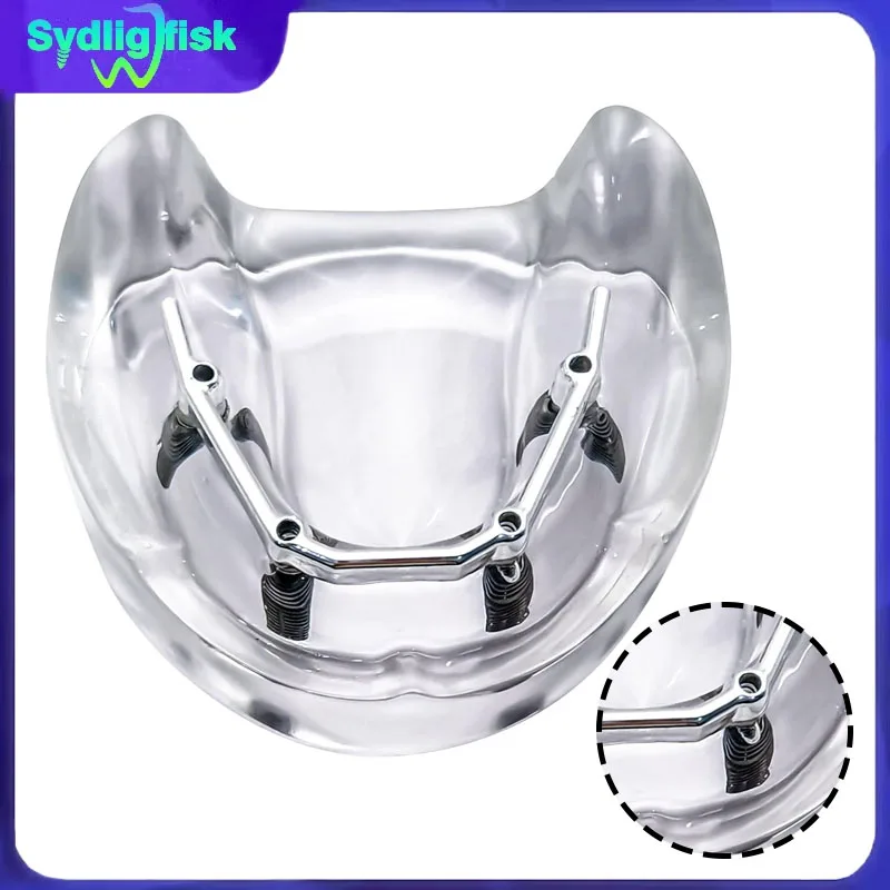 Зубной имплантат модель зубов 4 имплантаты зубной протез серебряный стержень