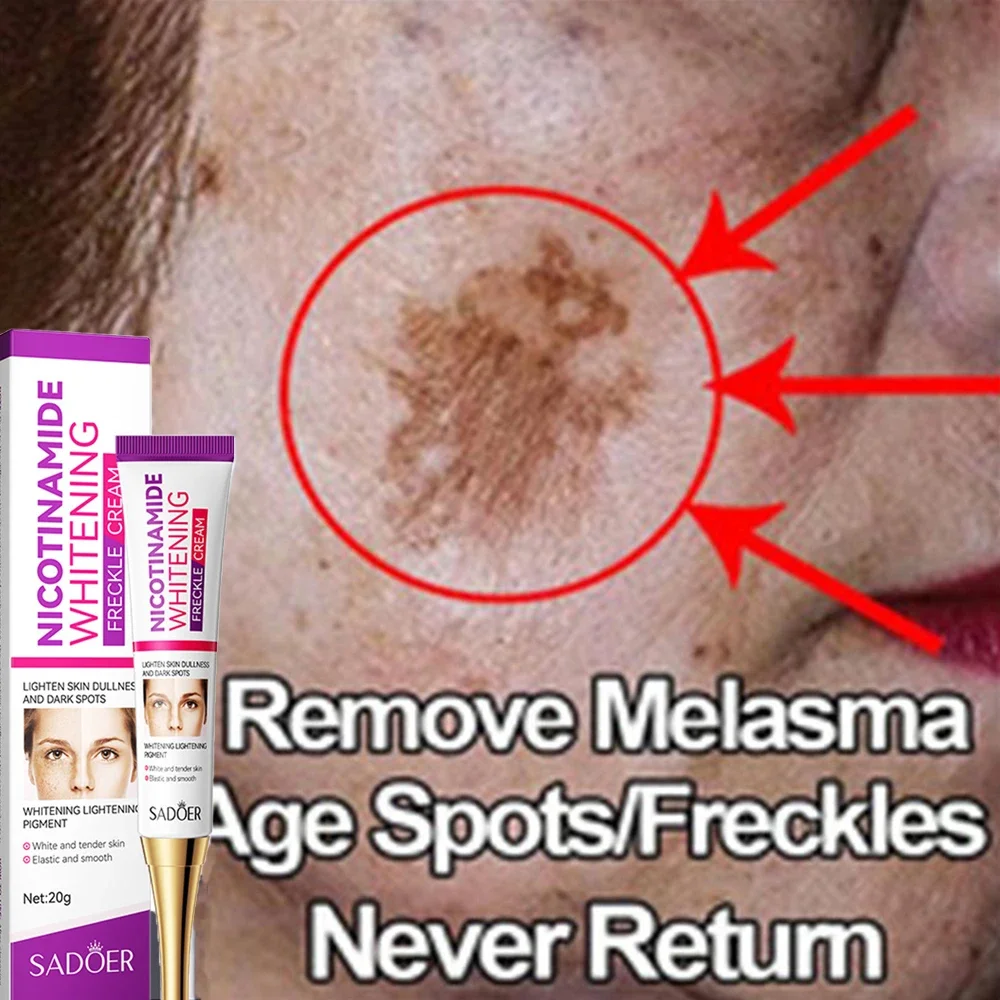 Отбеливающий крем от мелазмы темных точек веснушек Осветляющий никотинамид