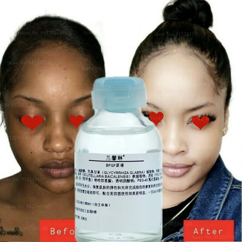 

Cell Growth Factor Repair Original Solution 30ml To Remove Red Blood, Eliminate Printing and Anti-aging Essence Skin Care