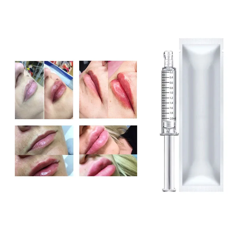 

2ml Hyaluronic Acid Serum Lip/Nose/Cheek Hyaluronic Acid Crosslinked HA Lips Enhancement for Hyaluron Pen Remove Wrinkles Kroea