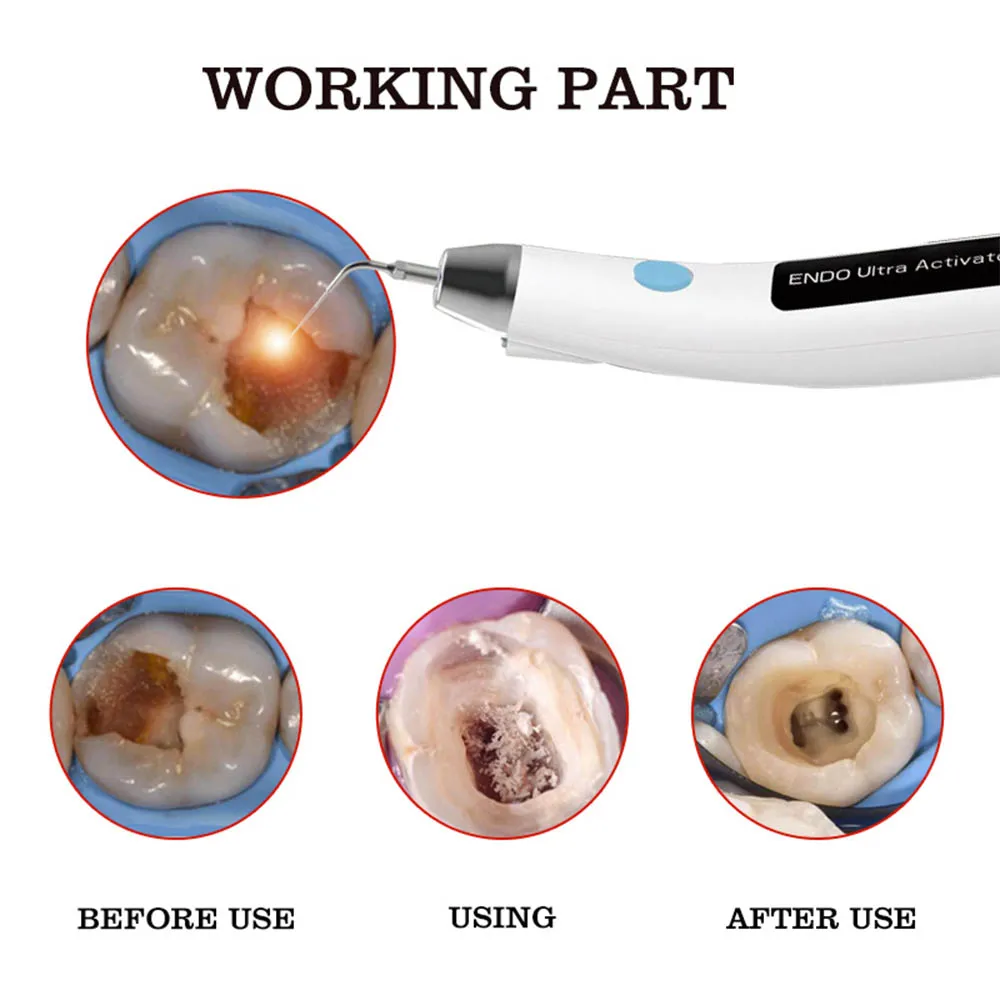 Drdent Dental Endodontic Ultrasonic Activator Cordless Endo Irrigator Handpiece With 6 Tips Root Canal Treatment Dentistry Endo