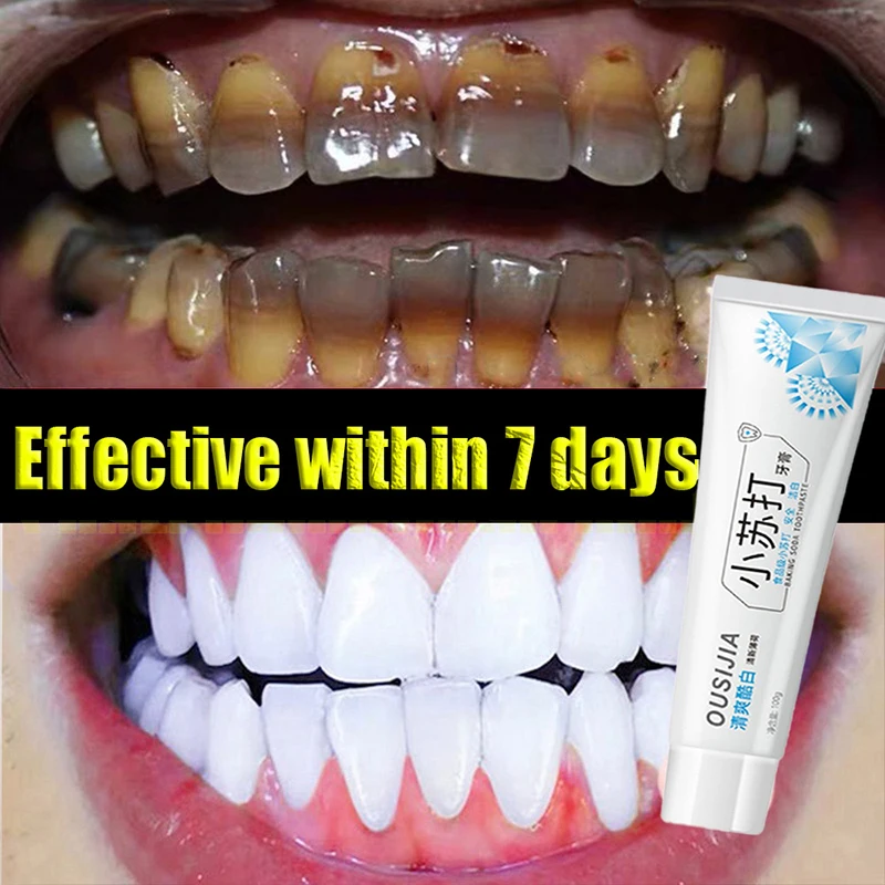 

Teeth Whitening Mousse Whitening Toothpaste Teeth Stain Remover Oral Hygiene Toothpaste Colour Corrector Colour Corrector 100g