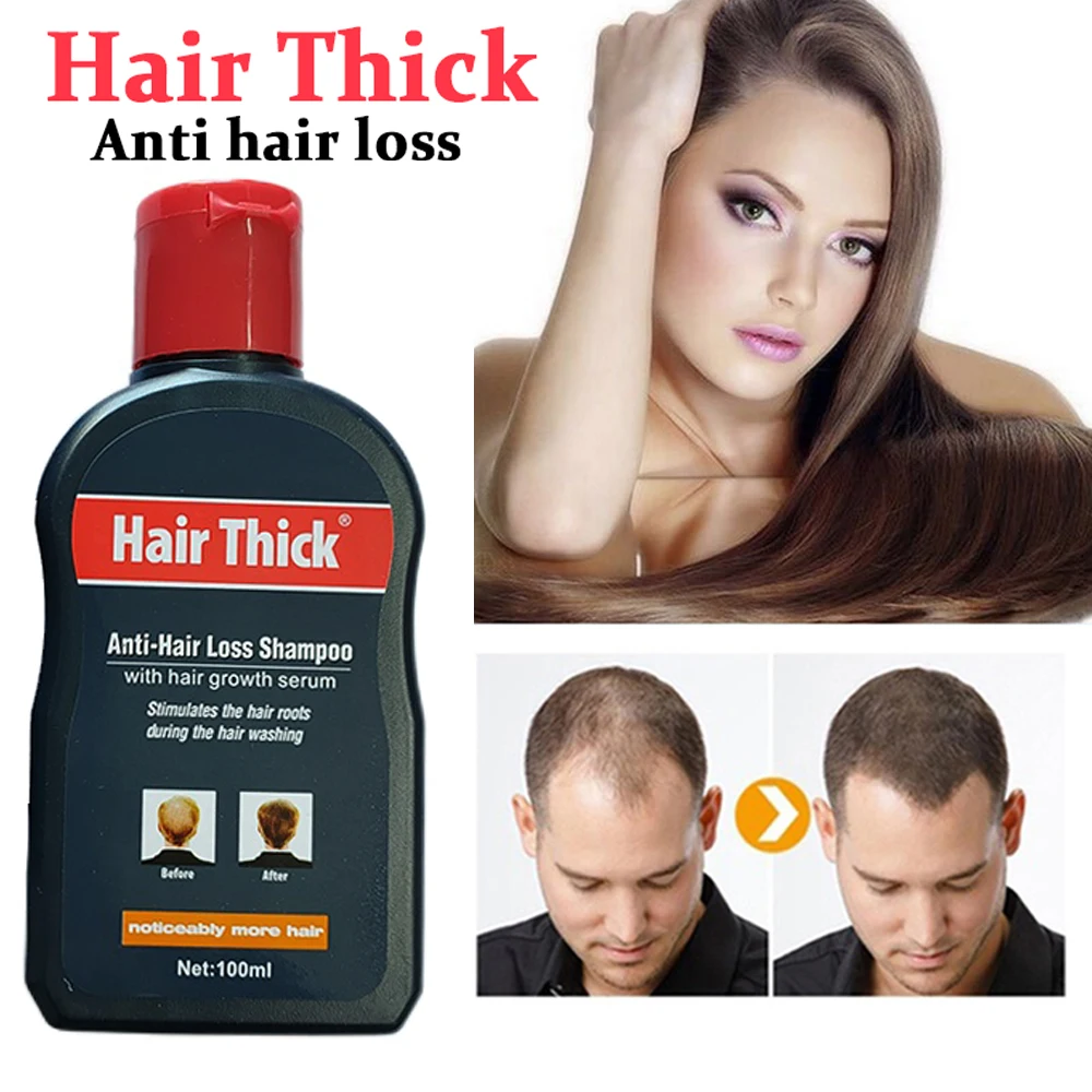Dexe Anti-hair Loss Shampoo Herbal Hair Growth Serum Anti-dandruff Relieve Oil-control Unisex Thin Hair Treatment Free Shipping
