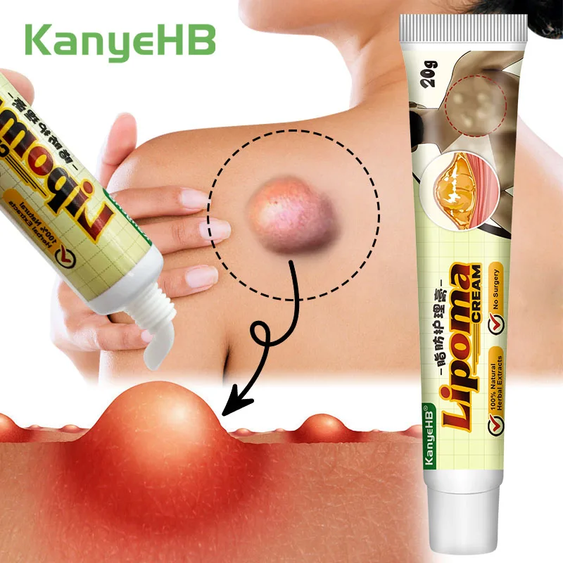 1 шт. крем для удаления Липомы