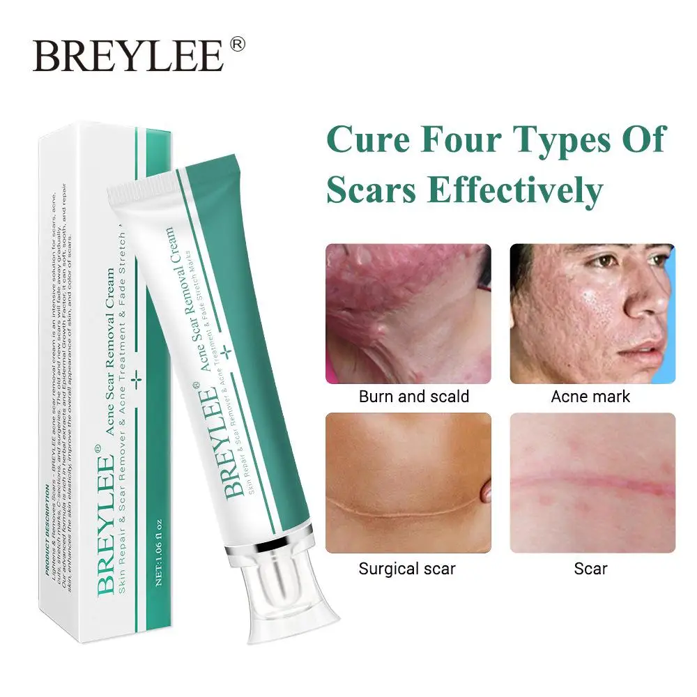 

1/3/5 Advanced Scar Cream Skin Repair Scars Treatment Smooth Whitening Effective Remove Burn Stretch Marks Acne Spots Body Care