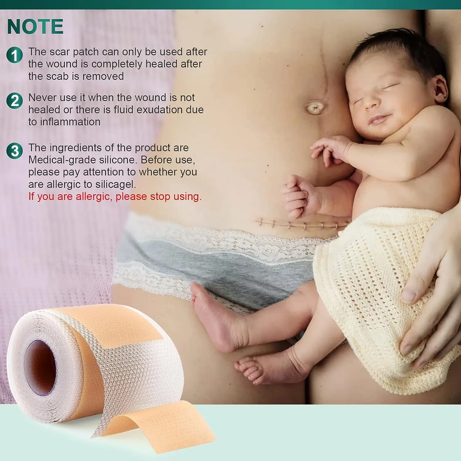 Пластырь силиконовый для удаления рубцов 150/450 см