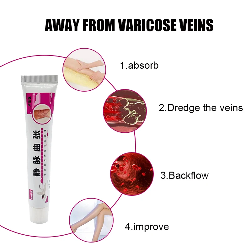 Крем от варикозного расширения вен способствует циркуляции крови и эффективно