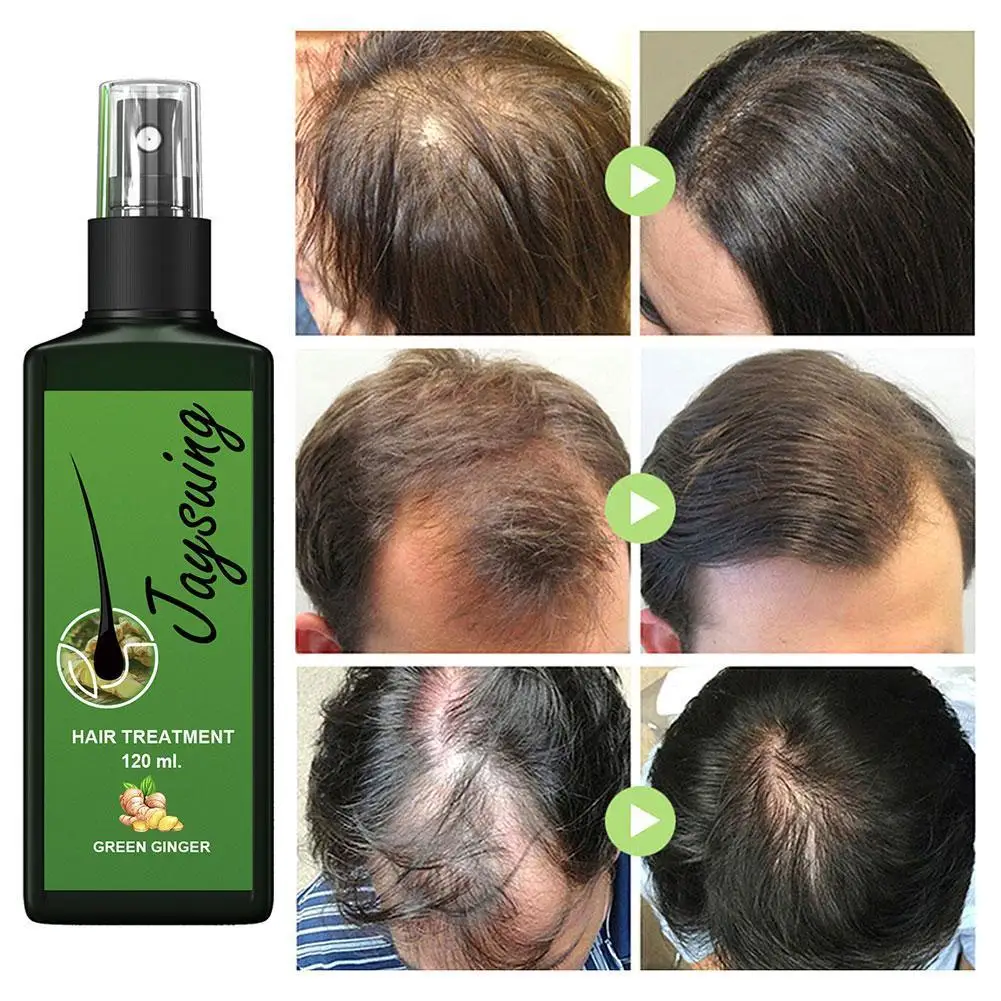 

Травяная Сыворотка для роста волос, 30 мл/120 мл, спрей против выпадения волос, сухой питательный лосьон, эссенция для лечения волос