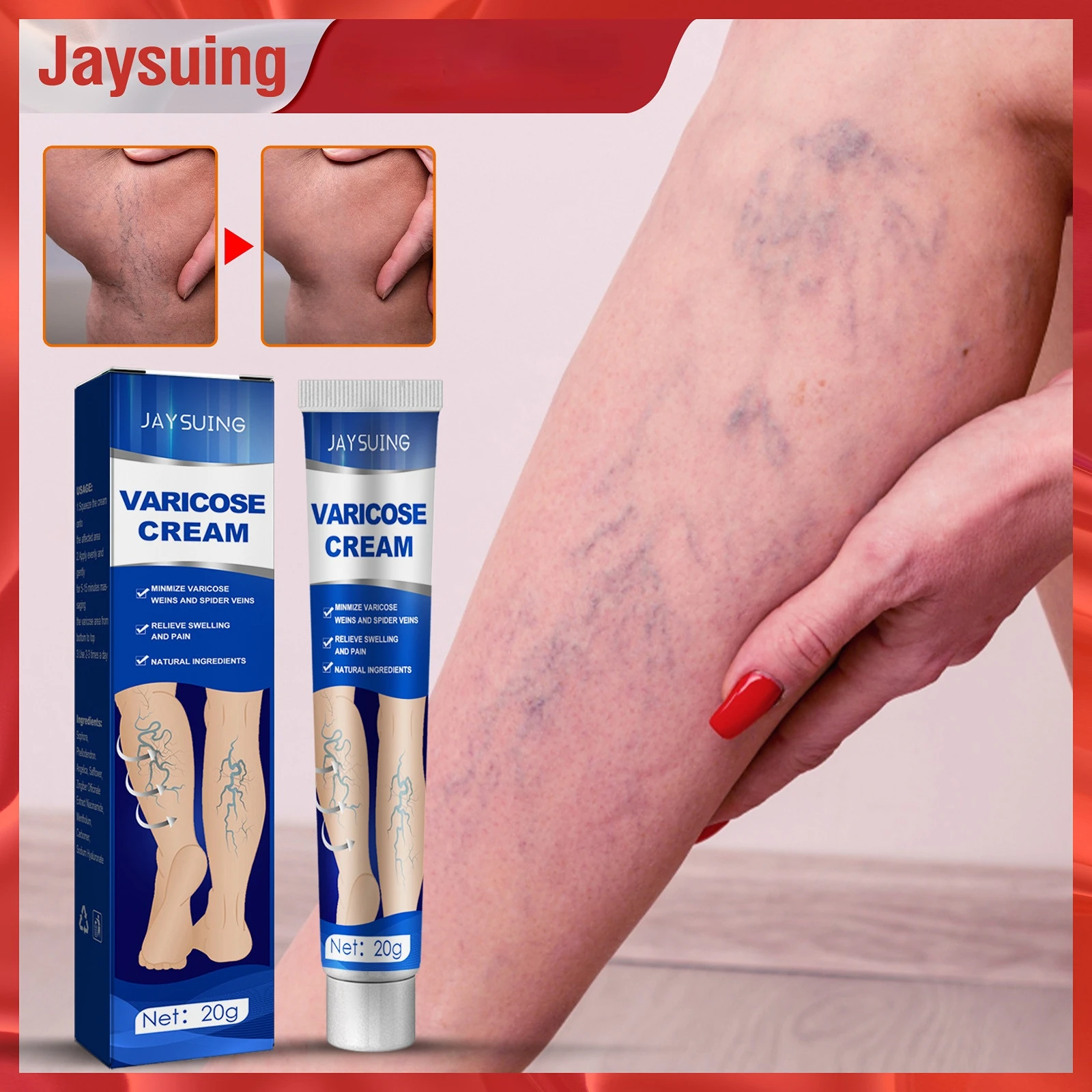 

Vein repair cream Tongmai relieves leg varicose bulge pain earthworm leg pain relief cream feet care