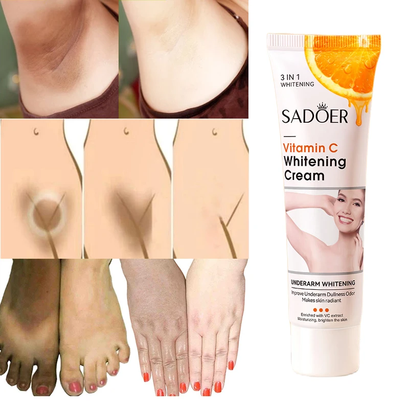 

VitaminC Whitening Cream Underarm Private Parts Legs Elbow Bleach Remove Melanin Pigmentation Moisturizing Brighten Beauty Care