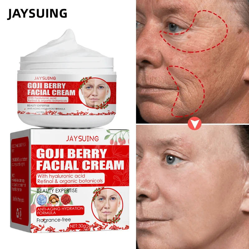 

GoJi Berry Anti-wrinkle Facial Cream Face Neck Forehead Lines Wrinkles Removal Cream Anti-aging Skin Firming Sodium Hyaluronate