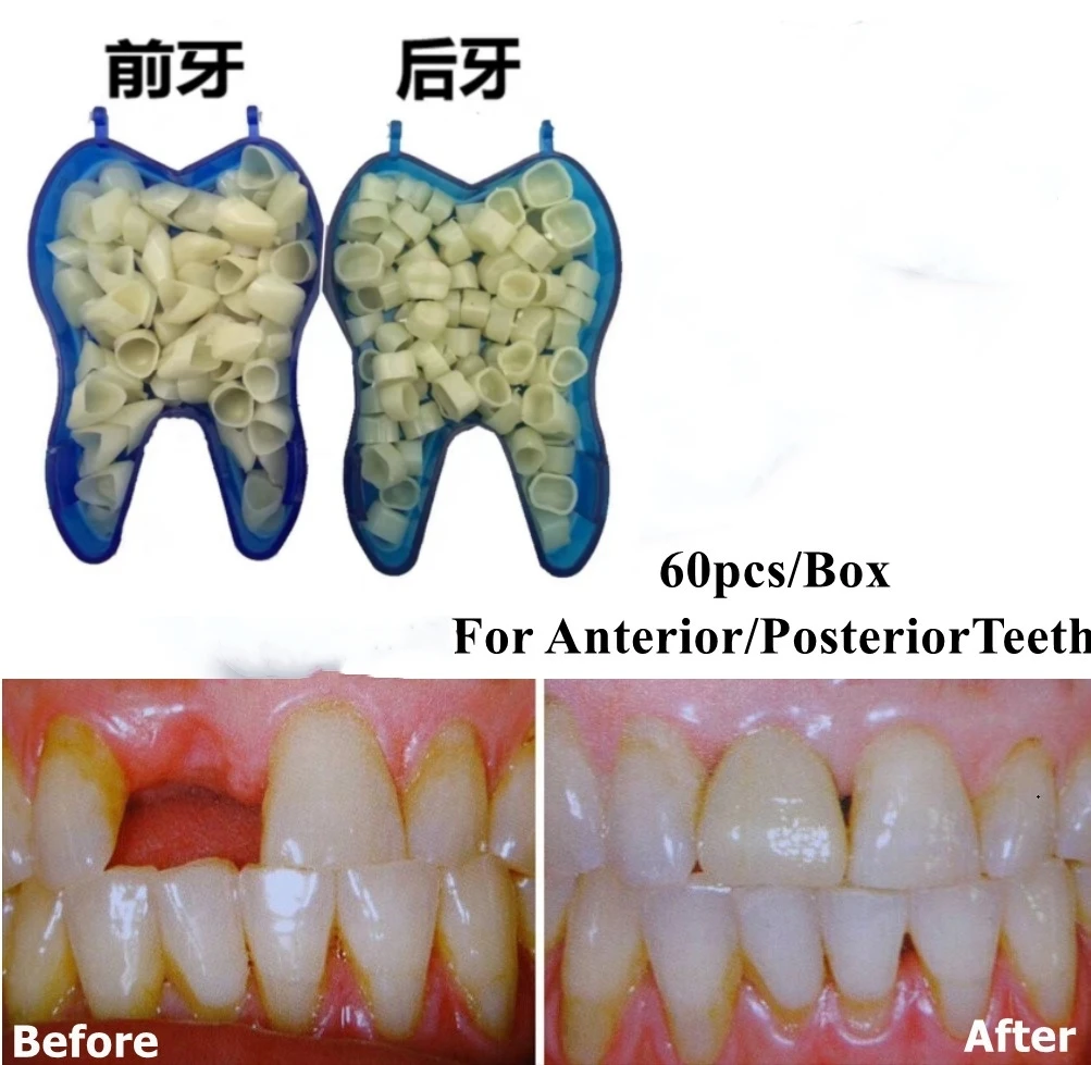 

60 шт./коробка, короны из стоматологической смолы