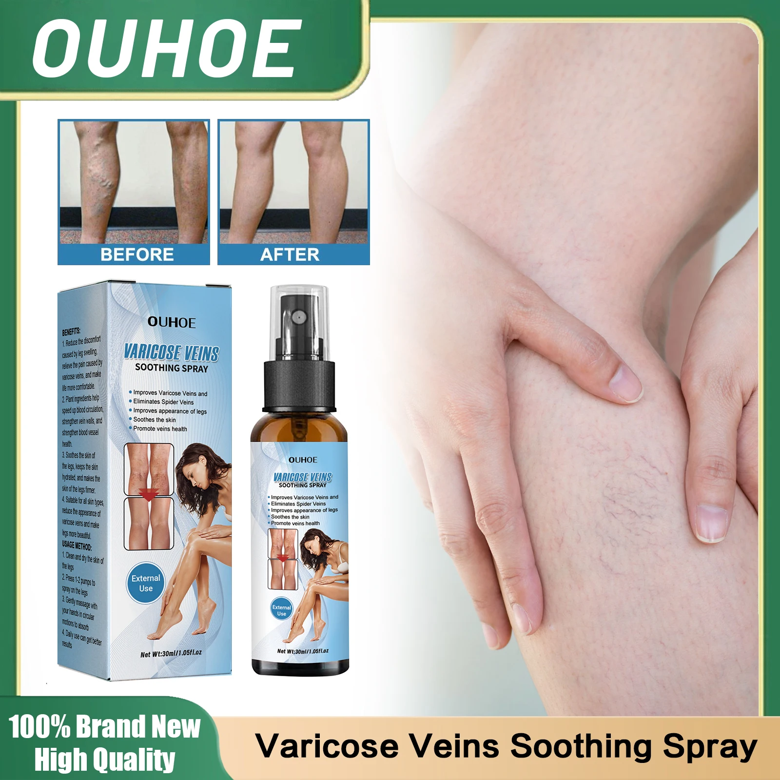 

Varicose Veins Soothing Spray Relieve Spider Pain Leg Swelling Eliminate Spider Earthworm Legs Varicosity Angiitis Removal Spray