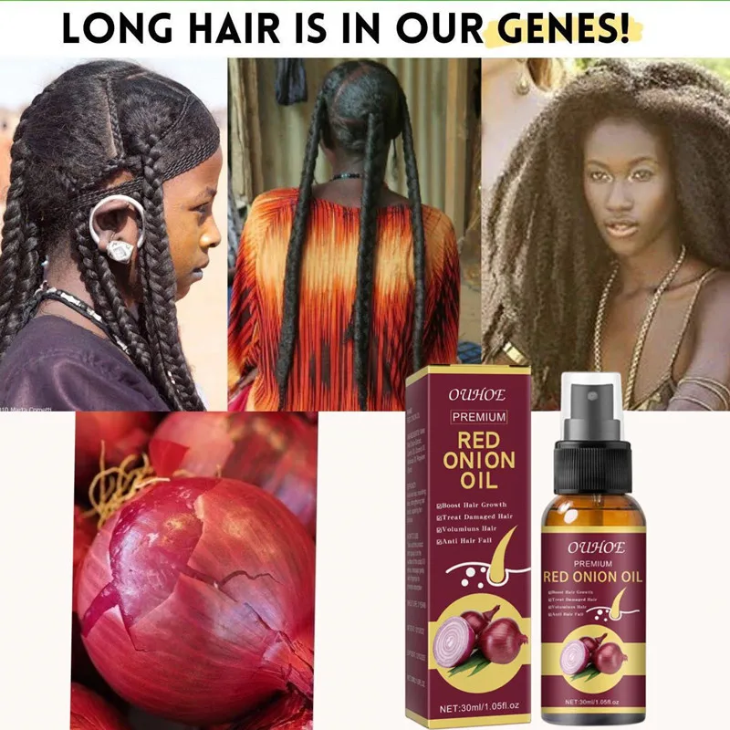 

Hair Growth Fast Onion Black Seed Essential Oils Oil Spray for Hair Care and Growth To Prevent Hair Loss Natural Hair Fast Grow