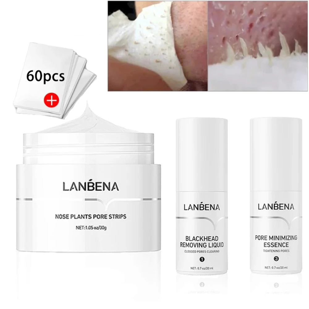 

Средство для удаления черных точек на лице, маска для удаления черных точек, полоски для очистки пор в носу, наклейки, лечение акне, средство для ухода за кожей лица