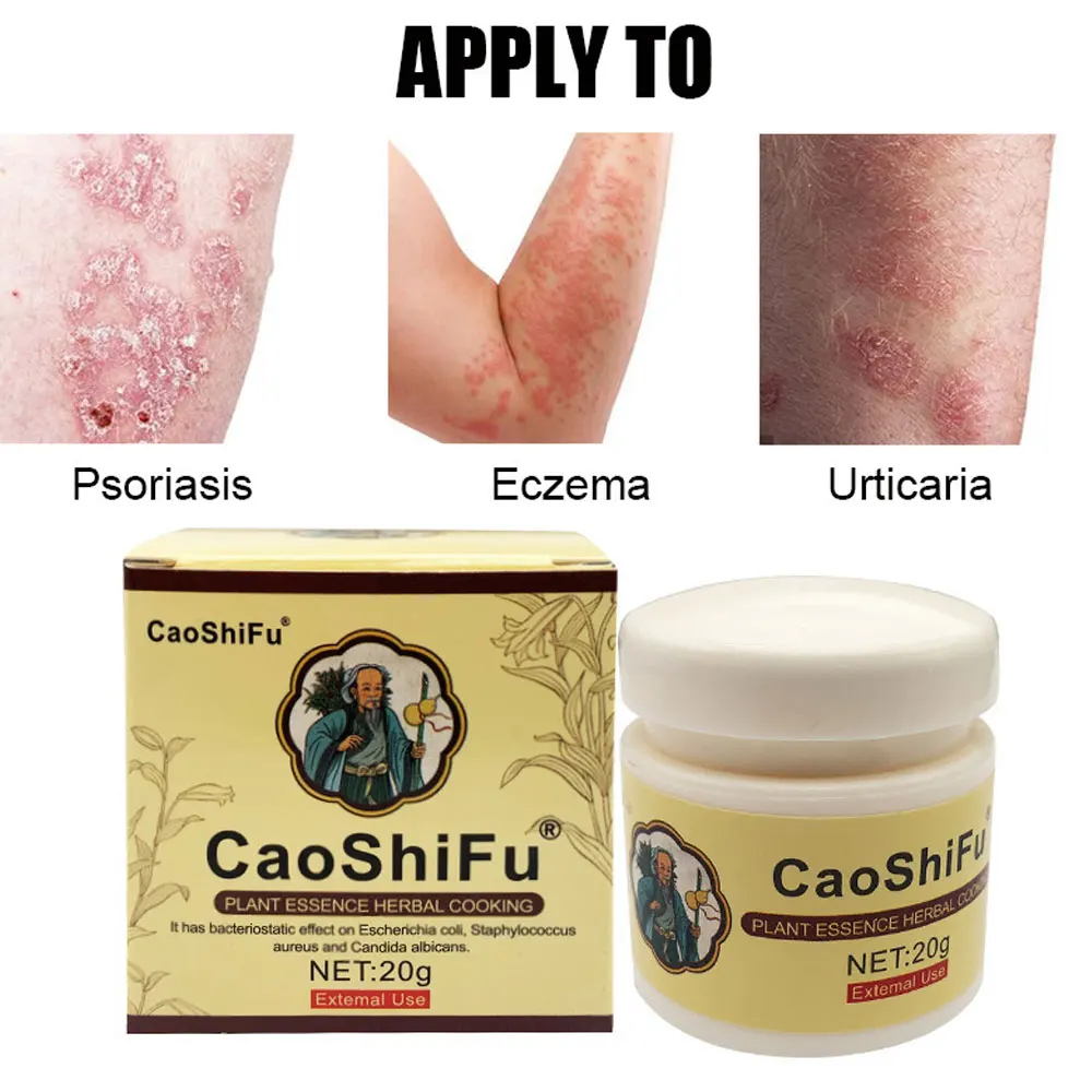 20 г мазь CAOSHIFU от псориаза для проблем на коже крем противозудный медицинский